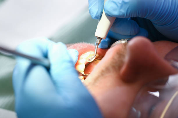 Best Emergency Gum Treatment in Fairfax, OH